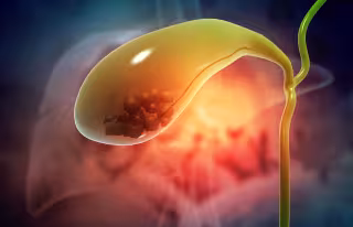 Gallbladder with stone
